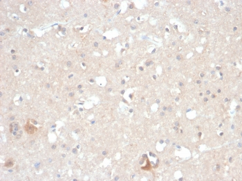 HSP90 beta Antibody / HSP90AB1
