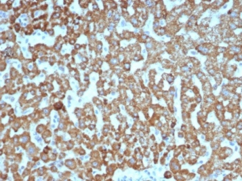 VEGF Antibody / Vascular Endothelial Growth Factor