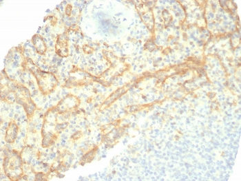 TIM-3 Antibody / HAVCR2
