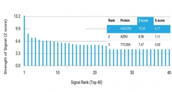 TIM-3 Antibody / HAVCR2