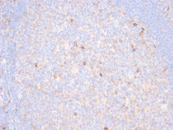 TIM-3 Antibody / HAVCR2