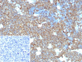 CD74 Antibody / CLIP