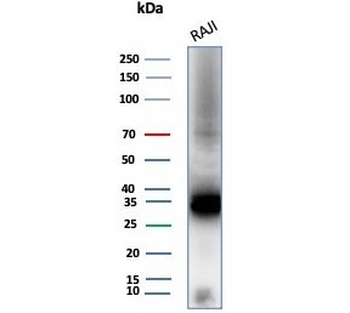 CD74 Antibody / CLIP