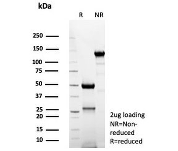 CD74 Antibody / CLIP