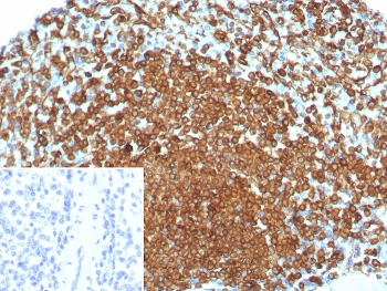 CD74 Antibody / CLIP
