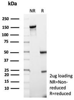 CD74 Antibody / CLIP