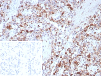 Osteonectin Antibody / SPARC