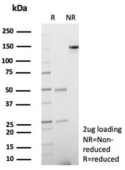 Osteonectin Antibody / SPARC