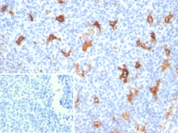 Osteonectin Antibody / SPARC