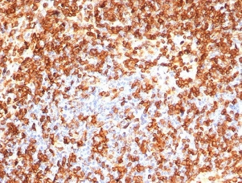 CD74 Antibody / CLIP
