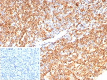CD74 Antibody / CLIP