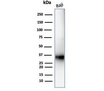 CD74 Antibody / CLIP