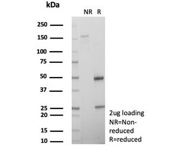 CD74 Antibody / CLIP