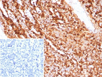 CD74 Antibody / CLIP