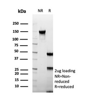 CD74 Antibody / CLIP