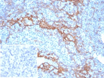 STING Antibody / MITA / ERIS / TMEM17