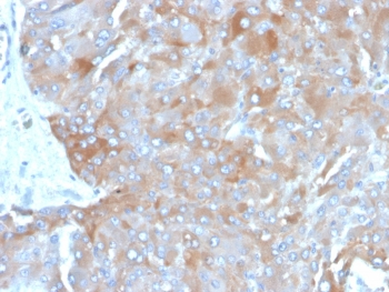 IL-3 Antibody / Interleukin 3
