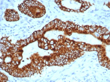 p504S Antibody / AMACR
