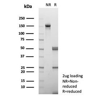 Interleukin-15 Antibody / IL15
