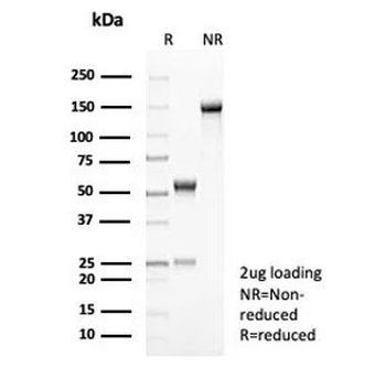 IL-2 Antibody
