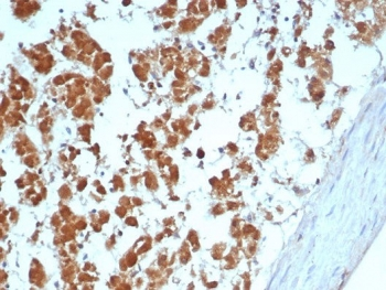 IL-2 Antibody