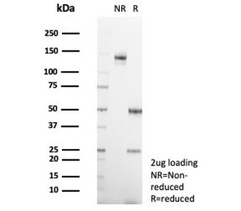 IL-2 Antibody