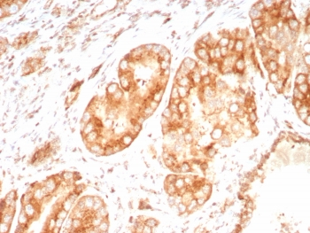 Osteopontin Antibody / Uropontin / SPP1