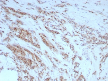 Uropontin Antibody / SPP1 / Osteopontin