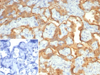 S100P Antibody