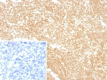 LDB2 Antibody / LIM domain binding 2