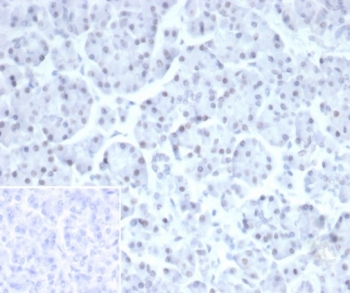 Paired-like homeobox 2B Antibody / PHOX2B