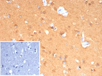 UchL1 Antibody / PGP9.5