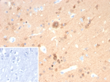 UchL1 Antibody / PGP9.5