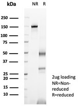 UchL1 Antibody / PGP9.5