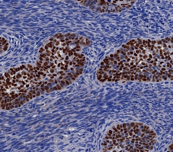 p40 Antibody / deltaNp63