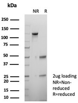 p40 Antibody / deltaNp63