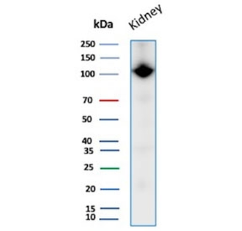 CD10 Antibody / Neutral endopeptidase 24.11 / Neprilysin
