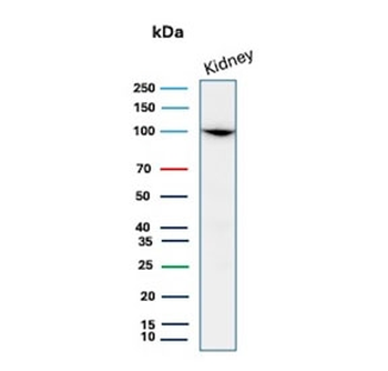 CD10 Antibody / Neutral endopeptidase 24.11 / Neprilysin