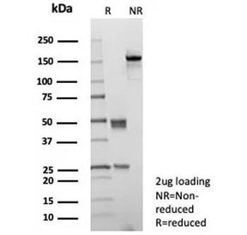 CD10 Antibody / Neutral endopeptidase 24.11 / Neprilysin
