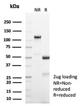 Forkhead box protein L2 Antibody / FOXL2