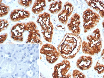 CD10 Antibody / CALLA / MME