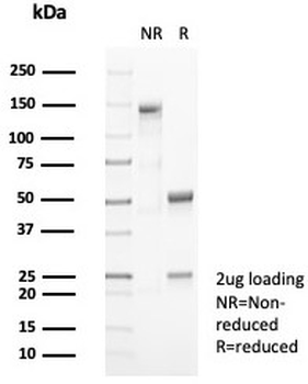 CD10 Antibody / CALLA / MME