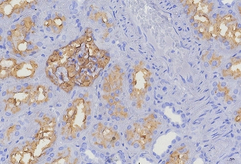 CD10 Antibody / Enkephalinase / MME