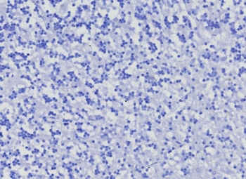 CD10 Antibody / Enkephalinase / MME