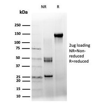 ZXDC Antibody / ZXD-like zinc finger protein