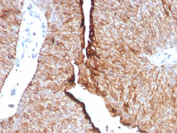 UPK1B Antibody / Uroplakin 1B