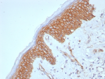 Beta Catenin Antibody / CTNNB1