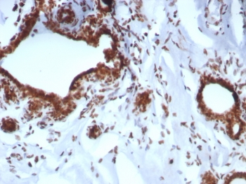 BRCA1-Associated Protein 1 Antibody / BAP1