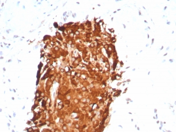 Inhibin alpha Antibody
