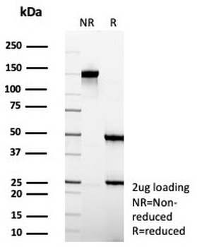 Villin Antibody / VIL1